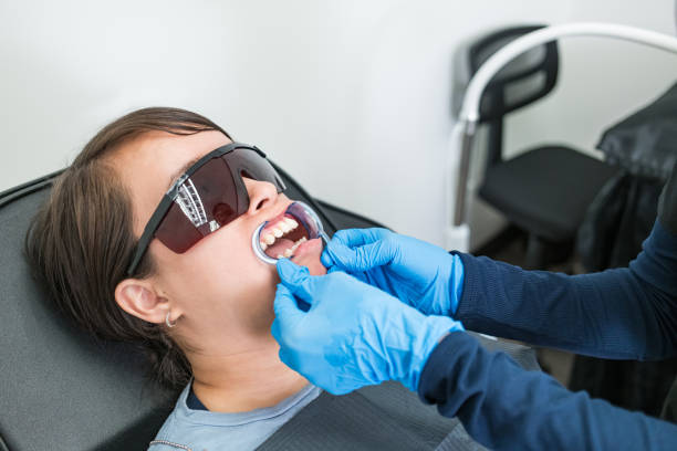 Best Knocked-Out Tooth (Avulsed Tooth) Treatment in Kingston, TN