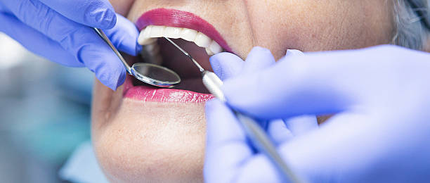 Best Emergency Dental Care for Sports Injuries in Kingston, TN